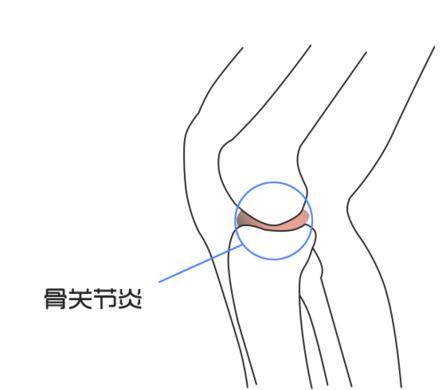 畫一種關(guān)節(jié)簡筆畫